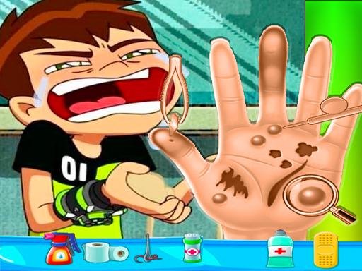 Ben10 Hand Doctor  Free Online Game Legends Challenge