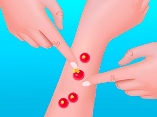 Pimple Poper Rush Land